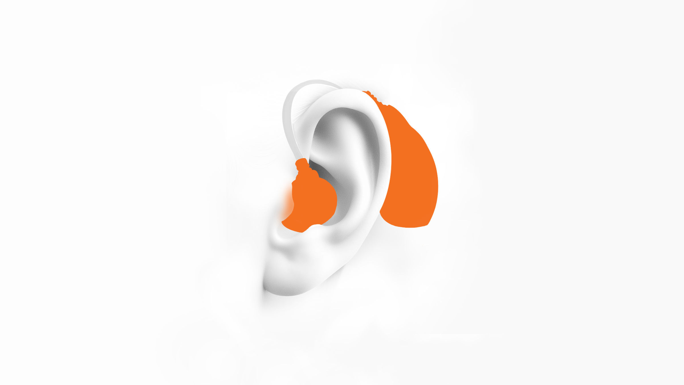 Behind the Ear Hearing Aids (BTE)