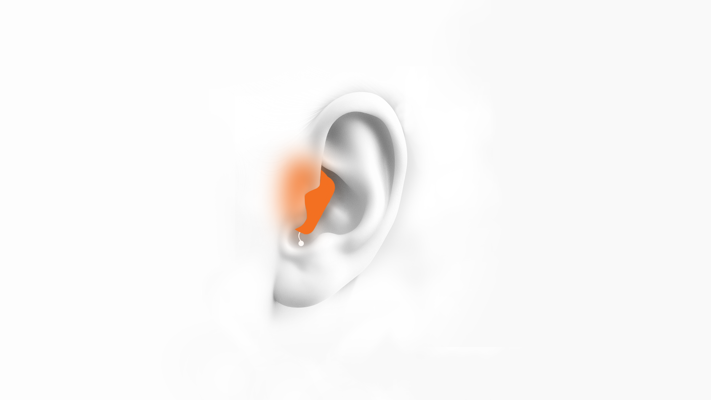 Completely in Canal Hearing Aids (CIC)