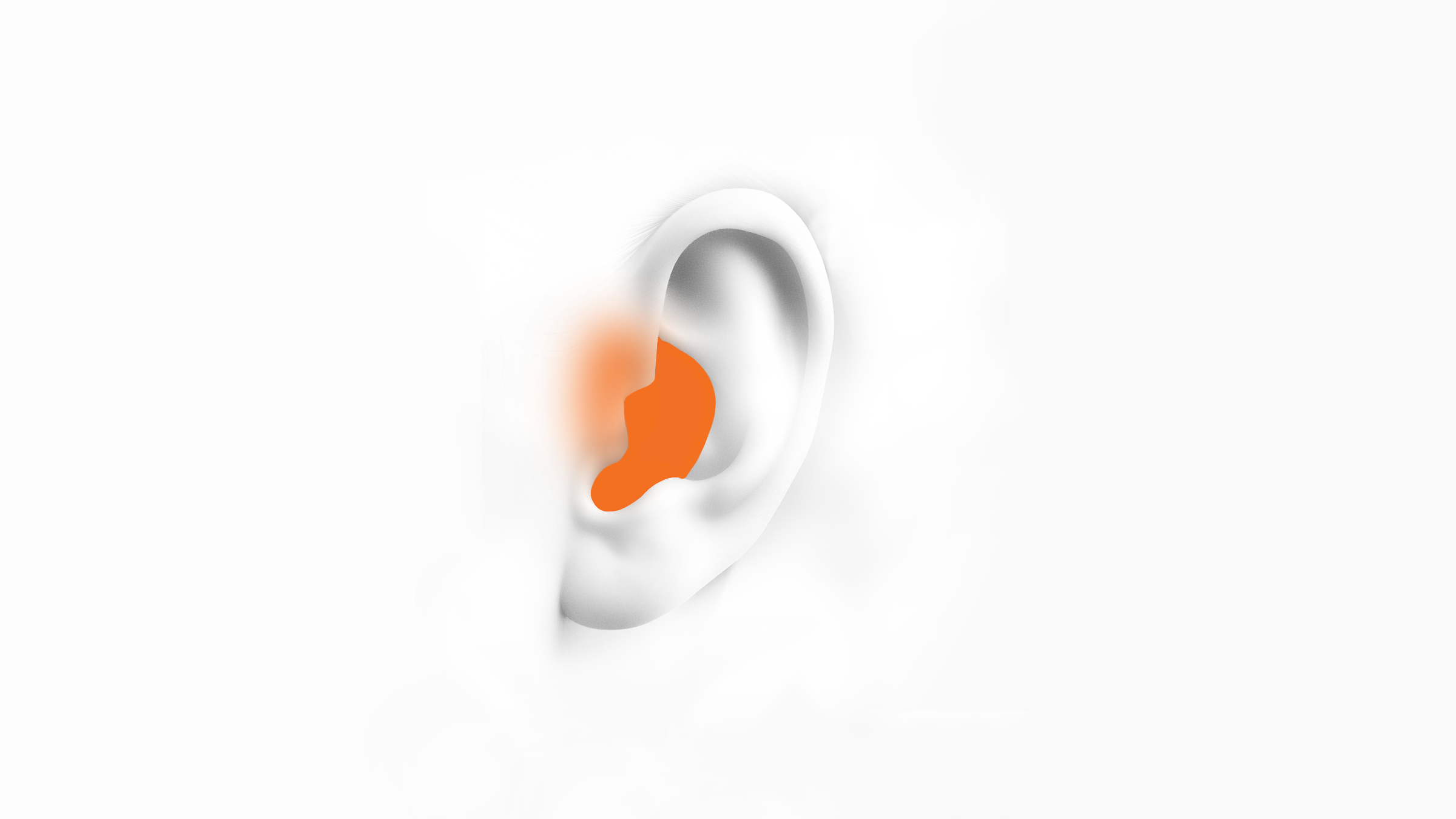 In The Ear Hearing Aids (ITE)